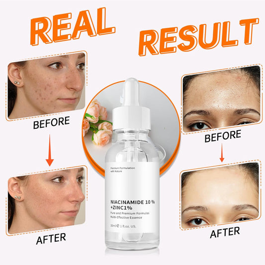Niacinamide 10% + Zinc 1% Serum, Anti-Aging Niacinamide Serum for Face, 2PCS Moisturizing Facial Serum for All Skin Type, Women Face Skin Care.